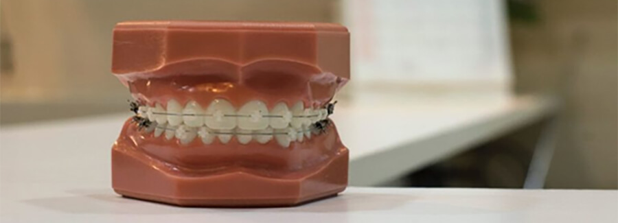 Dentist's model of teeth and gums.